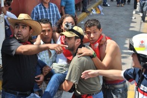 Una mujer sufrió fractura de fémur expuesta y fue traslada de emergencia al hospital de Salvatierra. Una mujer sufrió fractura de fémur expuesta y fue traslada de emergencia al hospital de Salvatierra.
